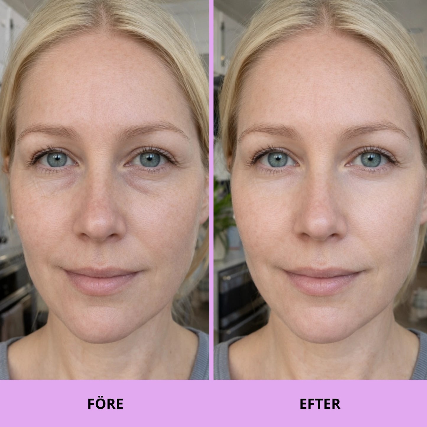 Glow Pads - Beauty Peptid & Koffein Eye pads