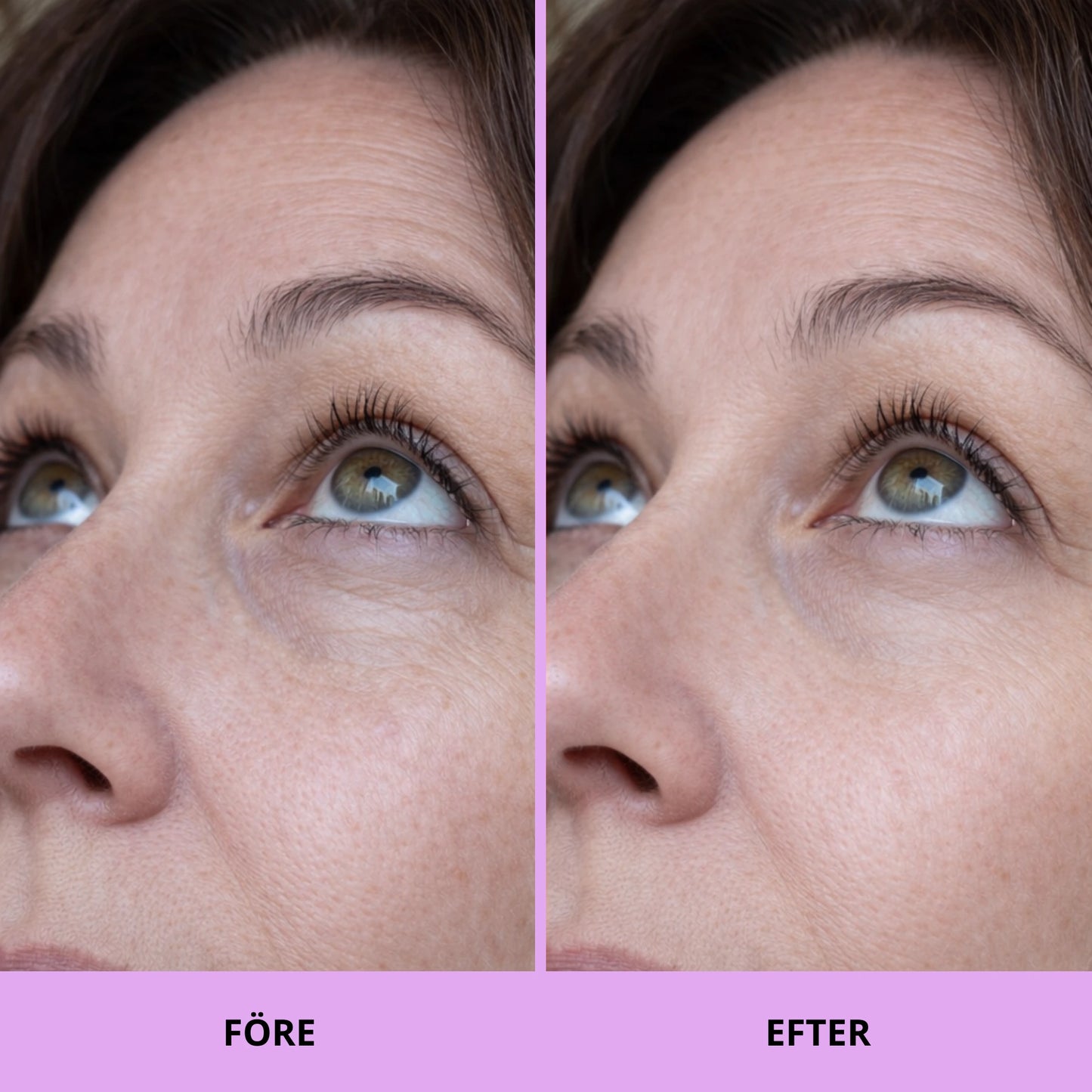 Glow Pads - Beauty Peptid & Koffein Eye pads