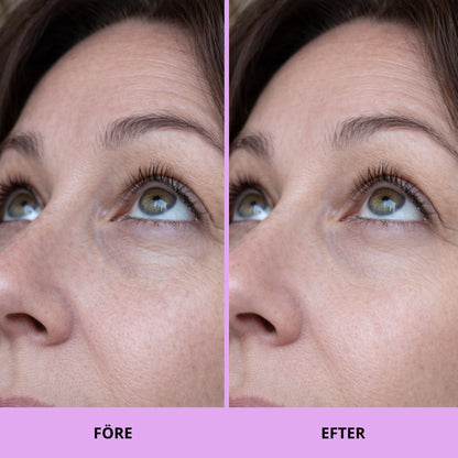 Glow Pads - Beauty Peptid & Koffein Eye pads